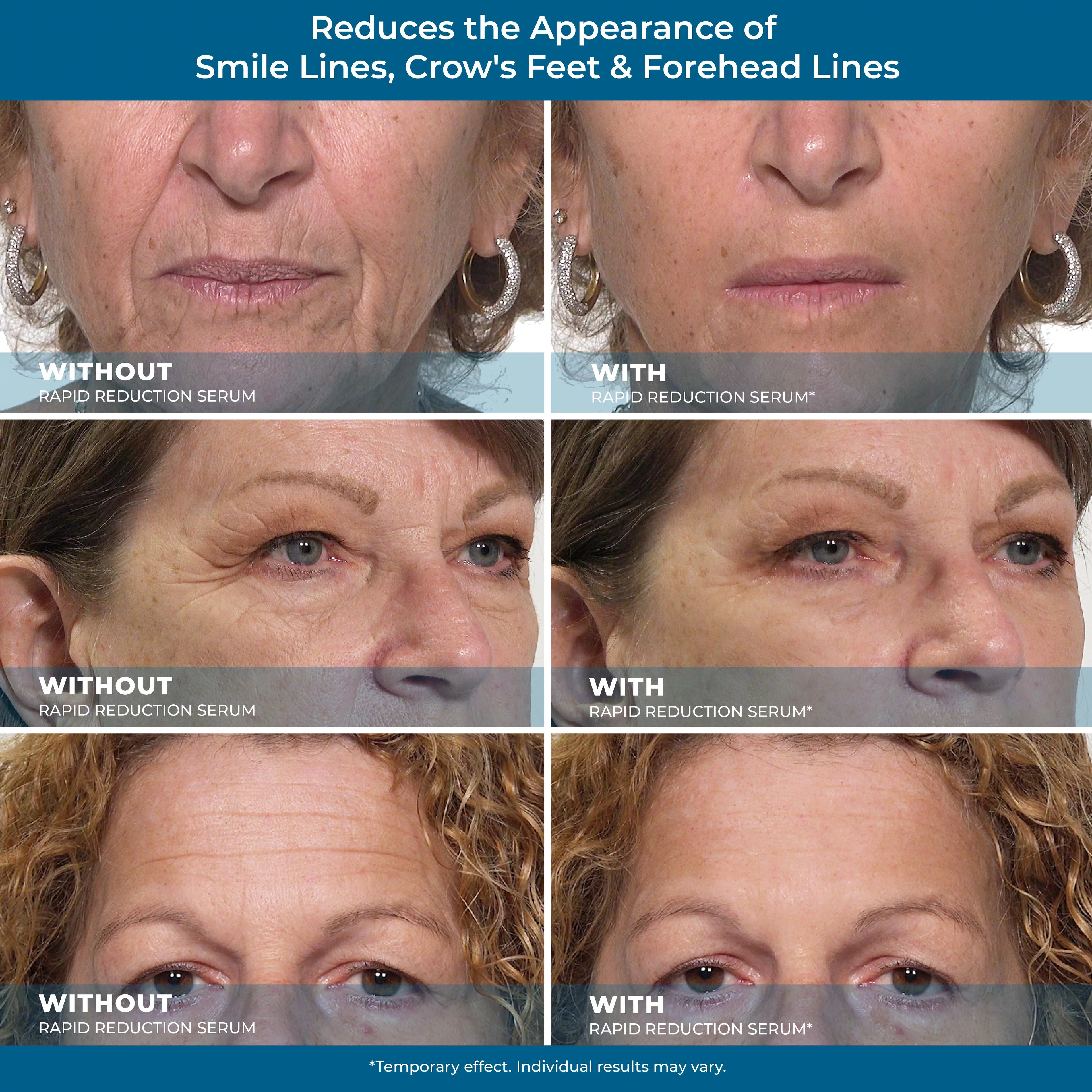 Rapid Reduction Eye Serum for Under-Eye Bags, Wrinkles & Dark Circles L153949